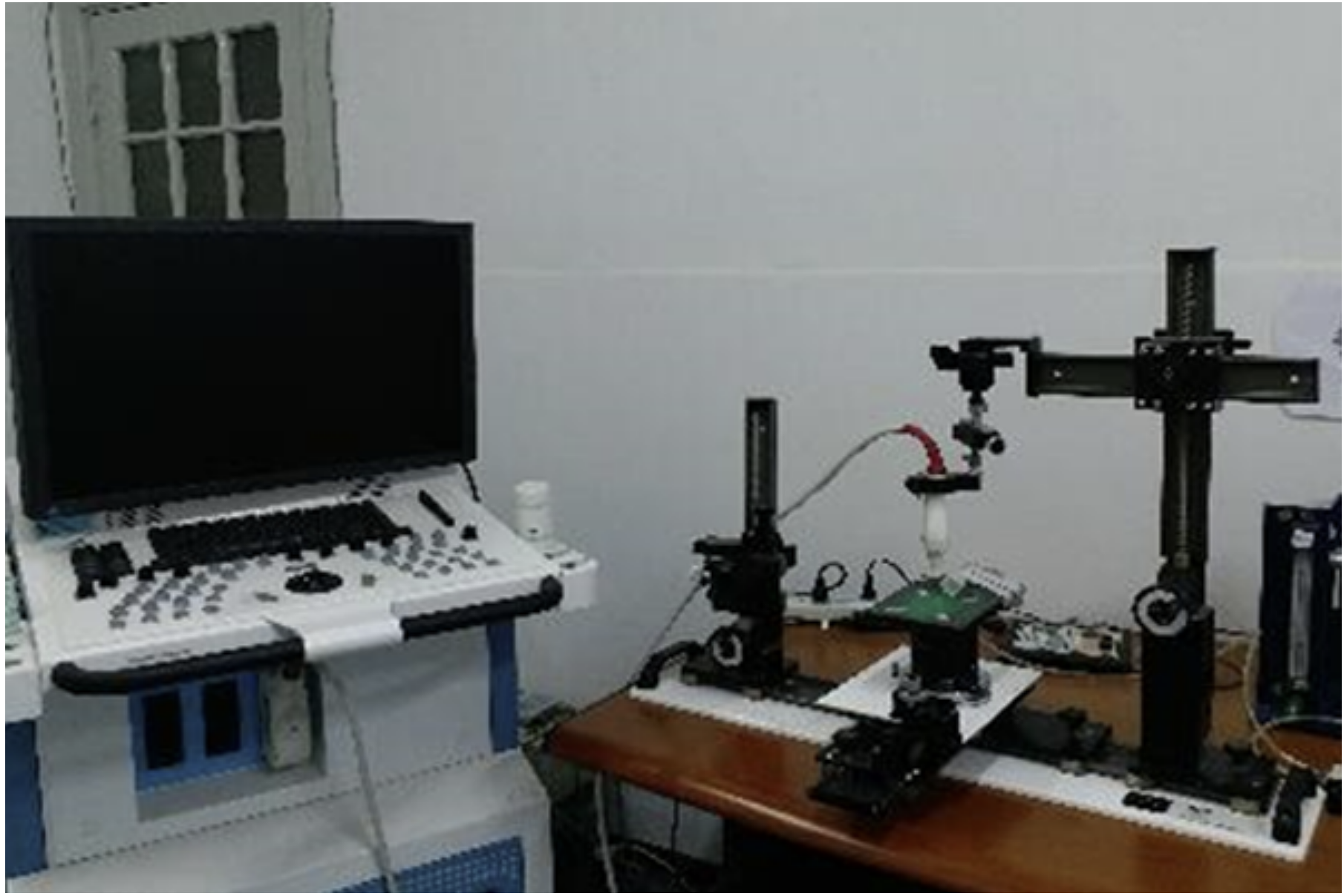 超聲心電圖(圖3)